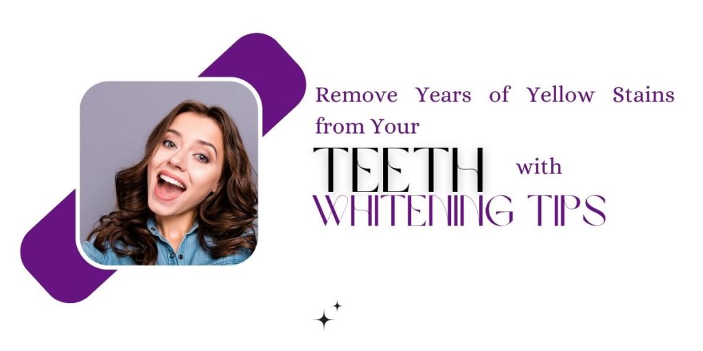 Best Remove Years of Yellow Stains from Your Teeth with Whitening Tips