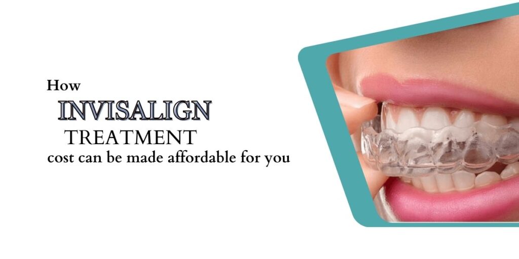 How Invisalign treatment cost can be made affordable for you
